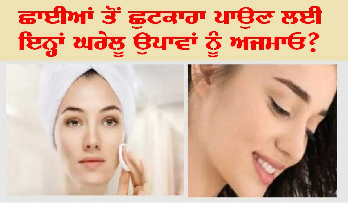 Home Remedies for Pigmentation : ਸਿਰਫ਼ 7 ਦਿਨਾਂ ’ਚ ਛਾਈਆਂ ਤੋਂ ਪਾਓ ਛੁਟਕਾਰਾ!
