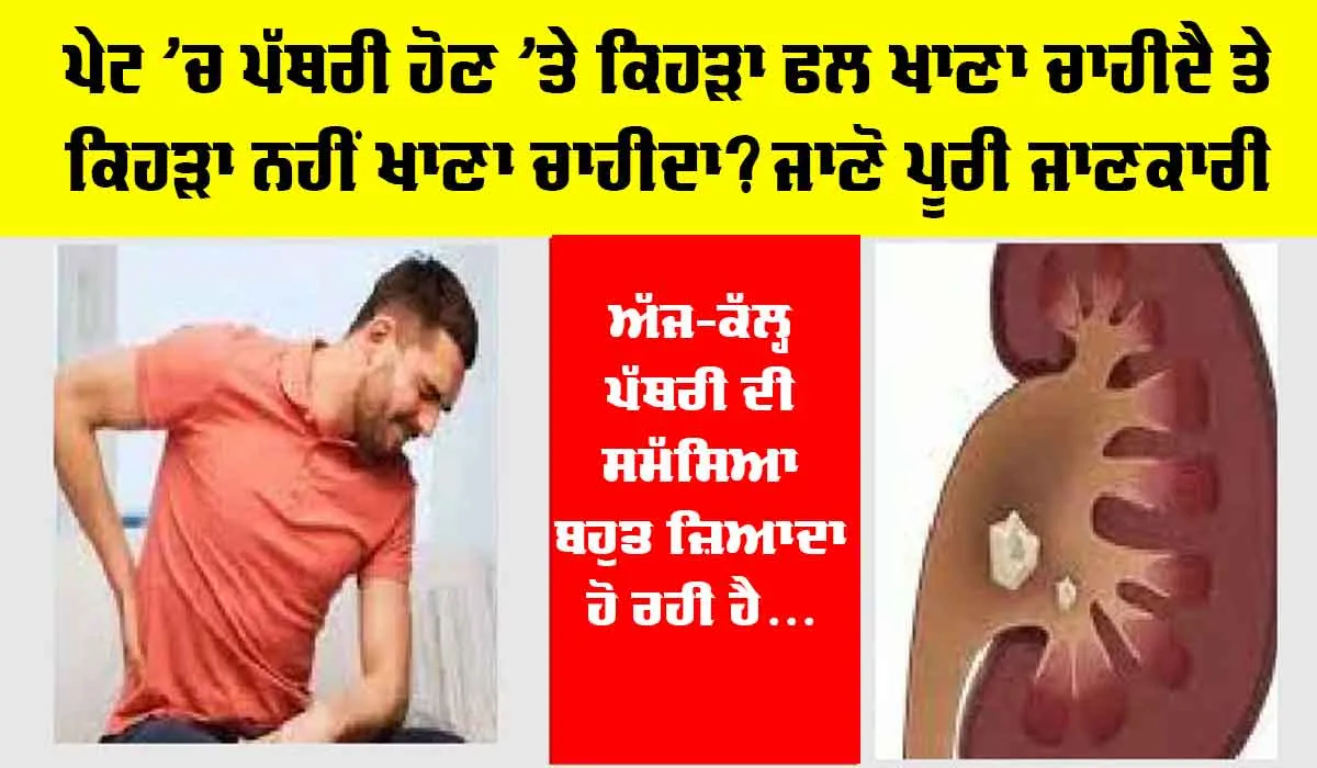 Stomach Stone: ਪੇਟ ’ਚ ਪੱਥਰੀ ਹੋਣ ’ਤੇ ਕਿਹੜਾ ਫਲ ਖਾਣਾ ਚਾਹੀਦੈ ਤੇ ਕਿਹੜਾ ਨਹੀਂ ਖਾਣਾ ਚਾਹੀਦਾ? ਜਾਣੋ ਪੂਰੀ ਜਾਣਕਾਰੀ
