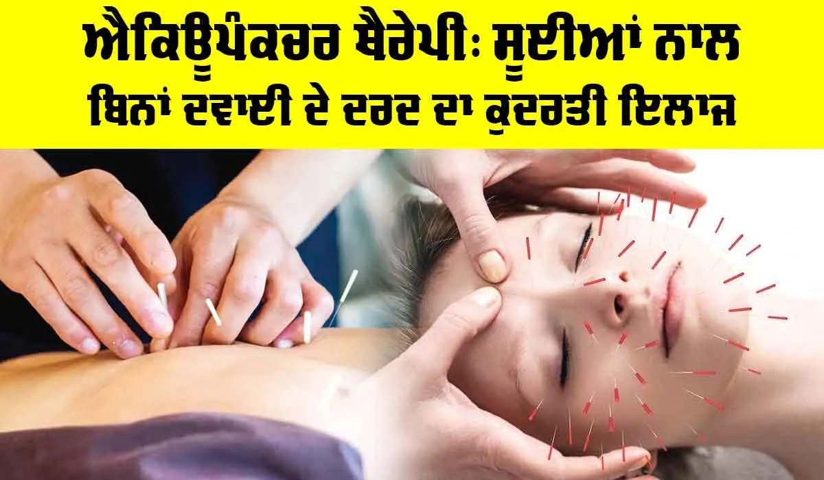 Acupuncture Therapy Benefits: ਐਕਿਊਪੰਕਚਰ ਥੈਰੇਪੀ, ਸੂਈਆਂ ਨਾਲ ਬਿਨਾਂ ਦਵਾਈ ਦੇ ਦਰਦ ਦਾ ਕੁਦਰਤੀ ਇਲਾਜ