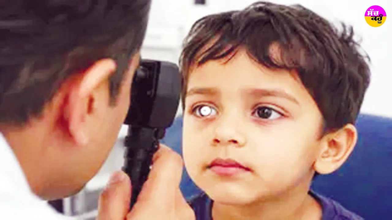 Children Eye Health: ਬੱਚਿਆਂ ਦੀਆਂ ਅੱਖਾਂ ’ਚ ਸਫ਼ੈਦ ਚਮਕ ਜਾਂ ਵਾਰ-ਵਾਰ ਭੈਂਗਾਪਣ ਦਿਸੇ ਤਾਂ ਇਸ ਨੂੰ ਨਜ਼ਰਅੰਦਾਜ਼ ਨਾ ਕਰੋ, ਤੁਰੰਤ ਮਾਹਿਰ ਤੋਂ ਜਾਂਚ ਕਰਵਾਓ