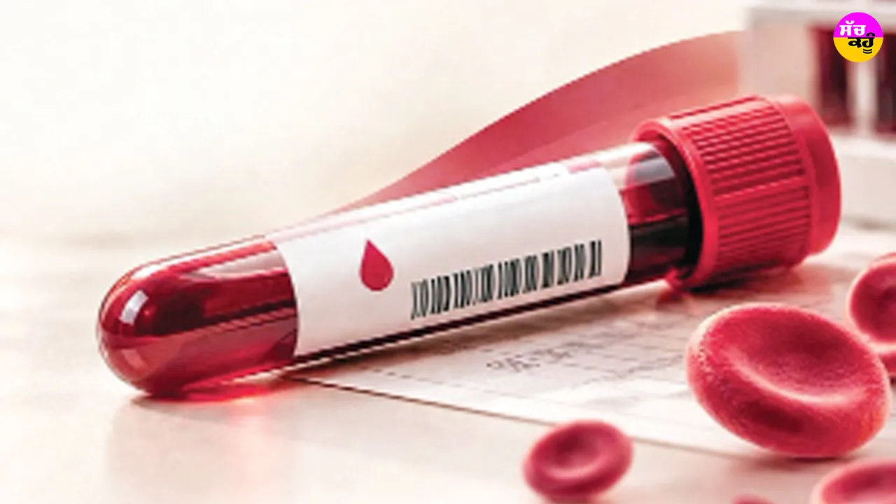 Hemoglobin Level: ਹੀਮੋਗਲੋਬਿਨ ਰਿਪੋਰਟ ’ਚ ਲੁਕੇ ਹਨ ਸਿਹਤ ਦੇ ਸੰਕੇਤ, ਏਦਾਂ ਸਮਝੋ ਐੱਚਬੀ ਲੈਵਲ