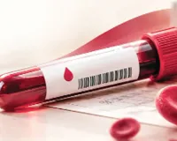 Hemoglobin Level: ਹੀਮੋਗਲੋਬਿਨ ਰਿਪੋਰਟ ’ਚ ਲੁਕੇ ਹਨ ਸਿਹਤ ਦੇ ਸੰਕੇਤ, ਏਦਾਂ ਸਮਝੋ ਐੱਚਬੀ ਲੈਵਲ