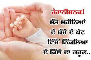 ਹੈਰਾਨੀਜਨਕ ਮਾਮਲਾ ! ਸੱਤ ਮਹੀਨਿਆਂ ਦੇ ਬੱਚੇ ਦੇ ਪੇਟ ’ਚ ਪਲ ਰਿਹਾ ਸੀ ਭਰੂਣ, ਆਪ੍ਰੇਸ਼ਨ ਨਾਲ ਕੱਢਿਆ