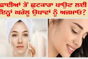 Home Remedies for Pigmentation : ਸਿਰਫ਼ 7 ਦਿਨਾਂ ’ਚ ਛਾਈਆਂ ਤੋਂ ਪਾਓ ਛੁਟਕਾਰਾ!