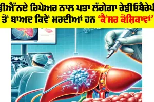 Health News: DNA ਰਿਪੇਅਰ ਨਾਲ ਪਤਾ ਲੱਗੇਗਾ ਰੇਡੀਓਥੈਰੇਪੀ ਤੋਂ ਬਾਅਦ ਕਿਵੇਂ ਮਰਦੀਆਂ ਹਨ ਕੈਂਸਰ ਕੋਸ਼ਿਕਾਵਾਂ