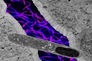 Gut Bacteria: ਅਮਰੀਕੀ ਵਿਗਿਆਨੀਆਂ ਨੇ ਖੋਜਿਆ ਅਜਿਹਾ ਗਟ ਬੈਕਟੀਰੀਆ ਜੋ ਭਾਰ ਘਟਾਉਣ ਵਿੱਚ ਵੀ ਮੱਦਦਗਾਰ