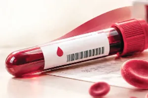 Hemoglobin Level: ਹੀਮੋਗਲੋਬਿਨ ਰਿਪੋਰਟ ’ਚ ਲੁਕੇ ਹਨ ਸਿਹਤ ਦੇ ਸੰਕੇਤ, ਏਦਾਂ ਸਮਝੋ ਐੱਚਬੀ ਲੈਵਲ