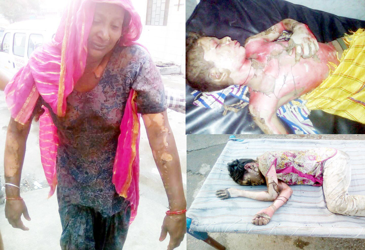 ਗੈਸ ਸਿਲੰਡਰ ਨੂੰ ਅੱਗ ਲੱਗਣ ਨਾਲ ਪੰਜ ਝੁਲਸੇ, ਇੱਕ ਦੀ ਮੌਤ