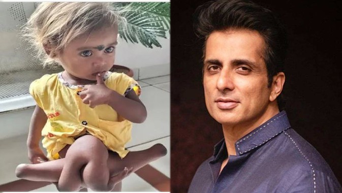 ਅਦਾਕਾਰ ਸੋਨੂੰ ਸੂਦ ਨੇ ਫਿਰ ਜਿੱਤਿਆ ਦਿਲ, ਚਾਰ ਹੱਥਾ-ਪੈਰਾਂ ਵਾਲੀ ਚੌਮੁਖੀ ਦਾ ਕਰਵਾਇਆ ਆਪਰੇਸ਼ਨ