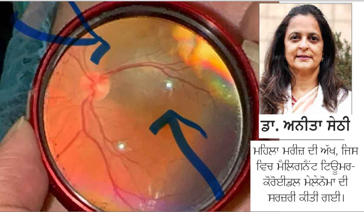 Tumor : ਦੁਰਲੱਭ ਤੇ ਜਾਨਲੇਵਾ ਹੈ ਇਹ ਟਿਊਮਰ, ਇਹ ਬਿਮਾਰੀ ਪਰਿਵਾਰ ’ਚ ਇੱਕ ਮੈਂਬਰ ਤੋਂ ਦੂਜੇ ਨੂੰ ਹੋਣ ਦੀ ਸੰਭਾਵਨਾ