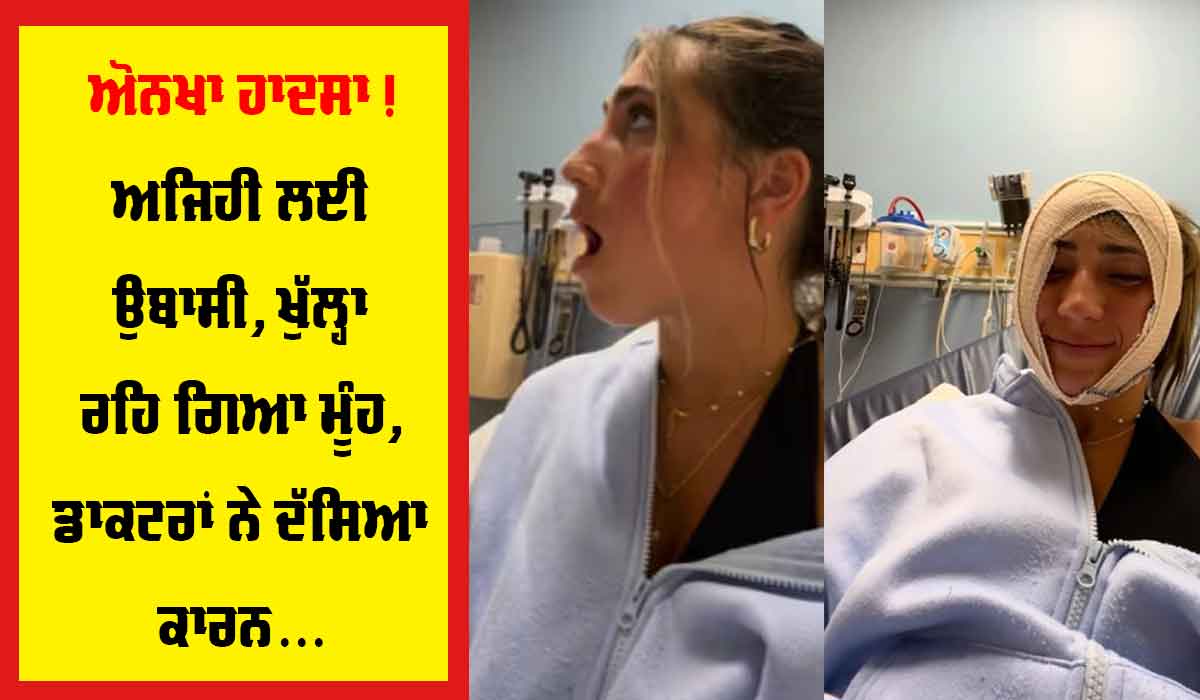 Viral News: ਹੈਰਾਨੀਜਨਕ ਹਾਦਸਾ, ਉਬਾਸੀ ਲੈਂਦਿਆਂ ਅਜਿਹਾ ਖੁੱਲ੍ਹਿਆ ਮੂੰਹ ਮੁੜ ਬੰਦ ਨਾ ਹੋਇਆ, ਡਾਕਟਰਾਂ ਨੇ ਦੱਸਿਆ ਕਾਰਨ