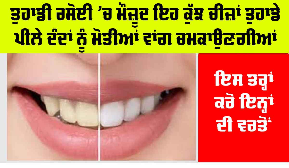 Teeth Cleaning Home Remedy: ਤੁਹਾਡੀ ਰਸੋਈ ’ਚ ਮੌਜ਼ੂਦ ਇਹ ਕੁੱਝ ਚੀਜ਼ਾਂ ਤੁਹਾਡੇ ਪੀਲੇ ਦੰਦਾਂ ਨੂੰ ਮੋਤੀਆਂ ਵਾਂਗ ਚਮਕਾਉਣਗੀਆਂ, ਜਾਣੋ ਕਿਵੇਂ ਕਰੀਏ ਵਰਤੋਂ