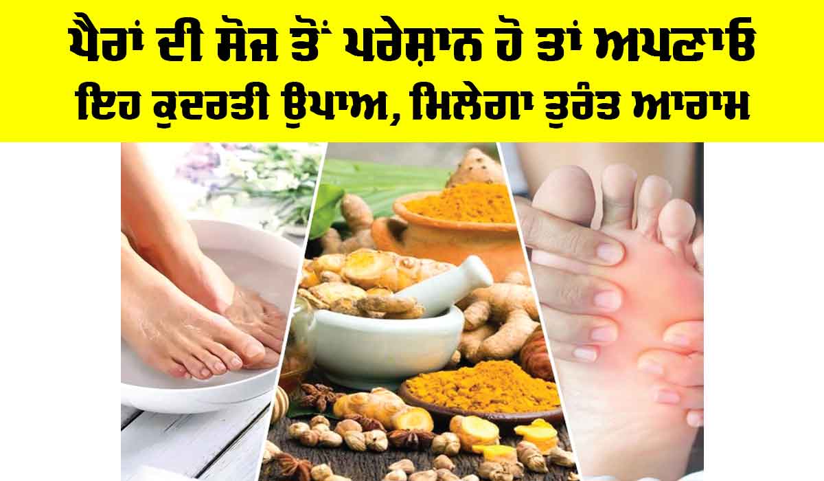 Foot Swelling: ਪੈਰਾਂ ਦੀ ਸੋਜ ਤੋਂ ਪਰੇਸ਼ਾਨ ਹੋ ਤਾਂ ਅਪਣਾਓ ਇਹ ਕੁਦਰਤੀ ਉਪਾਅ, ਮਿਲੇਗਾ ਤੁਰੰਤ ਆਰਾਮ