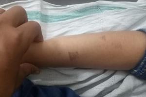 ਨਵ ਵਿਆਹੁਤਾ ਵੱਲੋਂ ਸਹੁਰੇ ਪਰਿਵਾਰ ‘ਤੇ ਗਰਮ ਪ੍ਰੈਸ ਤੇ ਚਿਮਟਿਆਂ ਨਾਲ ਜਖ਼ਮ ਕਰਨ ਦੇ ਦੋਸ਼