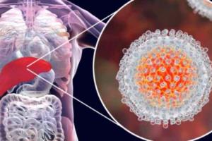 ਨਿਊਜ਼ੀਲੈਂਡ ‘ਚ ਕਰੀਬ 45 ਹਜ਼ਾਰ ਲੋਕ ਹੈਪੇਟਾਈਟਸ ਸੀ ਨਾਲ ਪੀੜਤ