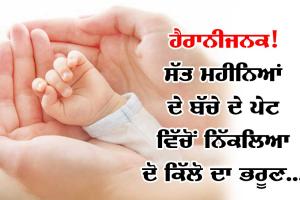 ਹੈਰਾਨੀਜਨਕ ਮਾਮਲਾ ! ਸੱਤ ਮਹੀਨਿਆਂ ਦੇ ਬੱਚੇ ਦੇ ਪੇਟ ’ਚ ਪਲ ਰਿਹਾ ਸੀ ਭਰੂਣ, ਆਪ੍ਰੇਸ਼ਨ ਨਾਲ ਕੱਢਿਆ