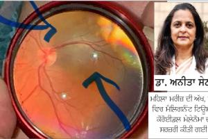 Tumor : ਦੁਰਲੱਭ ਤੇ ਜਾਨਲੇਵਾ ਹੈ ਇਹ ਟਿਊਮਰ, ਇਹ ਬਿਮਾਰੀ ਪਰਿਵਾਰ ’ਚ ਇੱਕ ਮੈਂਬਰ ਤੋਂ ਦੂਜੇ ਨੂੰ ਹੋਣ ਦੀ ਸੰਭਾਵਨਾ