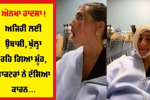 Viral News: ਹੈਰਾਨੀਜਨਕ ਹਾਦਸਾ, ਉਬਾਸੀ ਲੈਂਦਿਆਂ ਅਜਿਹਾ ਖੁੱਲ੍ਹਿਆ ਮੂੰਹ ਮੁੜ ਬੰਦ ਨਾ ਹੋਇਆ, ਡਾਕਟਰਾਂ ਨੇ ਦੱਸਿਆ ਕਾਰਨ