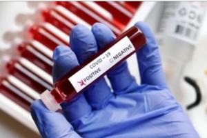 Coronavirus: ਸਿਹਤ ਮੰਤਰਾਲੇ ਨੇ ਕੋਰੋਨਾ ਸੰਬੰਧੀ ਐਡਵਾਈਜ਼ਰੀ ਕੀਤੀ ਜਾਰੀ, ਪਿਛਲੇ 20 ਦਿਨਾਂ ਤੋਂ ਬੰਗਲੁਰੂ ’ਚ ਮਾਮਲੇ ਵਧੇ