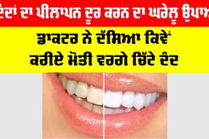 Dant Chamkane Ka Gharelu Upay: ਦੰਦਾਂ ਦਾ ਪੀਲਾਪਨ ਦੂਰ ਕਰਨ ਦਾ ਘਰੇਲੂ ਉਪਾਅ, ਡਾਕਟਰ ਨੇ ਦੱਸਿਆ ਕਿਵੇਂ ਕਰੀਏ ਮੋਤੀ ਵਰਗੇ ਚਿੱਟੇ ਦੰਦ