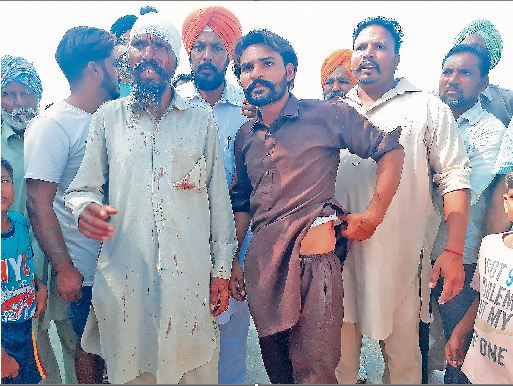 Supporters, Akali Dal, Bandage, Swords, Attacked