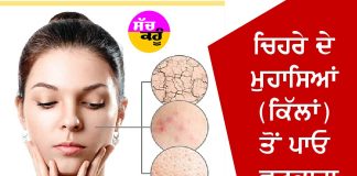 Get rid of facial acne