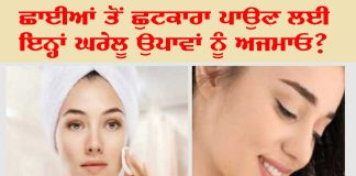 Home Remedies for Pigmentation