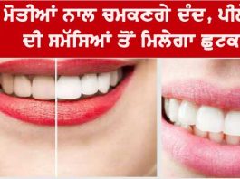 Yellow Teeth Home Remedies