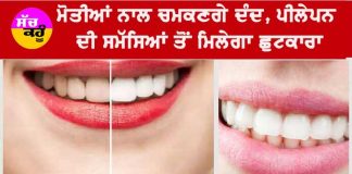 Yellow Teeth Home Remedies