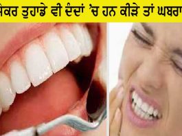 Teeth Cavity Remedies