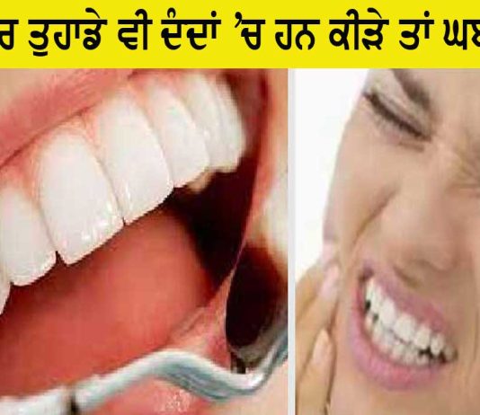 Teeth Cavity Remedies : ਜੇਕਰ ਤੁਹਾਡੇ ਵੀ ਦੰਦਾਂ ’ਚ ਹਨ ਕੀੜੇ ਤਾਂ ਘਬਰਾਓ ਨਾ, ਇਹ ਘਰੇਲੂ ਨੁਸਖੇ ਅਪਣਾਓ ਅਤੇ ਤੁਰੰਤ ਛੁਟਕਾਰਾ ਪਾਓ! Teeth Cavity Remedies