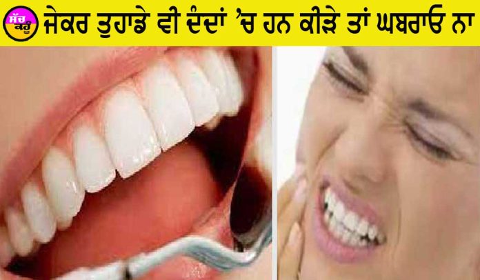 Teeth Cavity Remedies