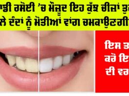 Teeth Cleaning Home Remedy