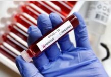 Coronavirus