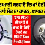 MRI Scan