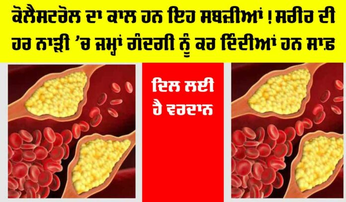 High Cholesterol