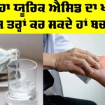 Uric Acid Symptoms