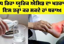 Uric Acid Symptoms