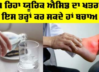 Uric Acid Symptoms