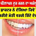 Dant Chamkane Ka Gharelu Upay: ਦੰਦਾਂ ਦਾ ਪੀਲਾਪਨ ਦੂਰ ਕਰਨ ਦਾ ਘਰੇਲੂ ਉਪਾਅ, ਡਾਕਟਰ ਨੇ ਦੱਸਿਆ ਕਿਵੇਂ ਕਰੀਏ ਮੋਤੀ ਵਰਗੇ ਚਿੱਟੇ ਦੰਦ Dant Chamkane Ka Gharelu Upay