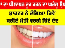 Dant Chamkane Ka Gharelu Upay