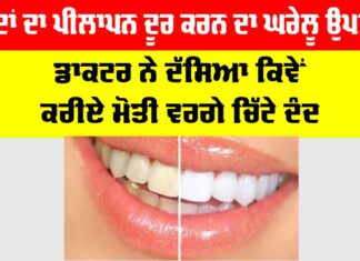 Dant Chamkane Ka Gharelu Upay