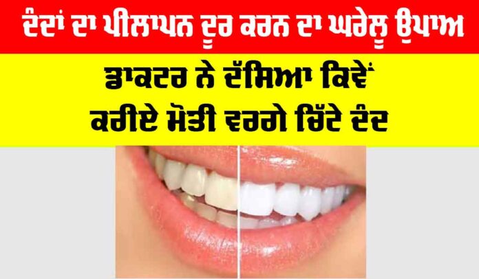 Dant Chamkane Ka Gharelu Upay