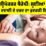 Acupuncture Therapy Benefits: ਐਕਿਊਪੰਕਚਰ ਥੈਰੇਪੀ, ਸੂਈਆਂ ਨਾਲ ਬਿਨਾਂ ਦਵਾਈ ਦੇ ਦਰਦ ਦਾ ਕੁਦਰਤੀ ਇਲਾਜ Acupuncture Therapy Benefits
