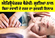 Acupuncture Therapy Benefits: ਐਕਿਊਪੰਕਚਰ ਥੈਰੇਪੀ, ਸੂਈਆਂ ਨਾਲ ਬਿਨਾਂ ਦਵਾਈ ਦੇ ਦਰਦ ਦਾ ਕੁਦਰਤੀ ਇਲਾਜ Acupuncture Therapy Benefits