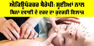 Acupuncture Therapy Benefits