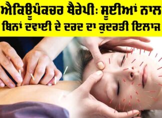 Acupuncture Therapy Benefits